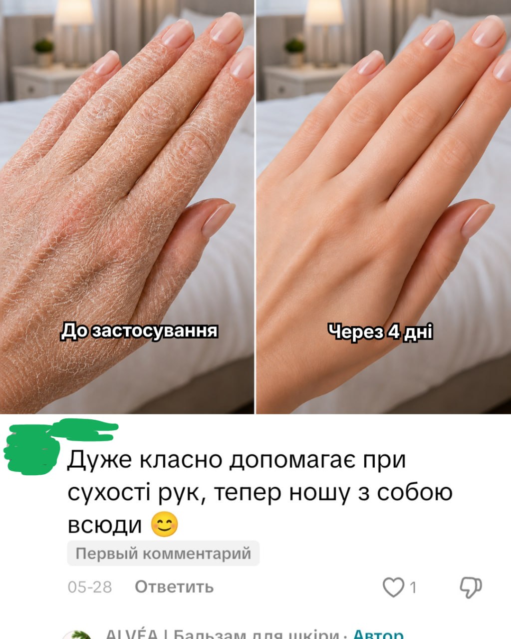 Відгук покупця ALVEA — лікті до/після