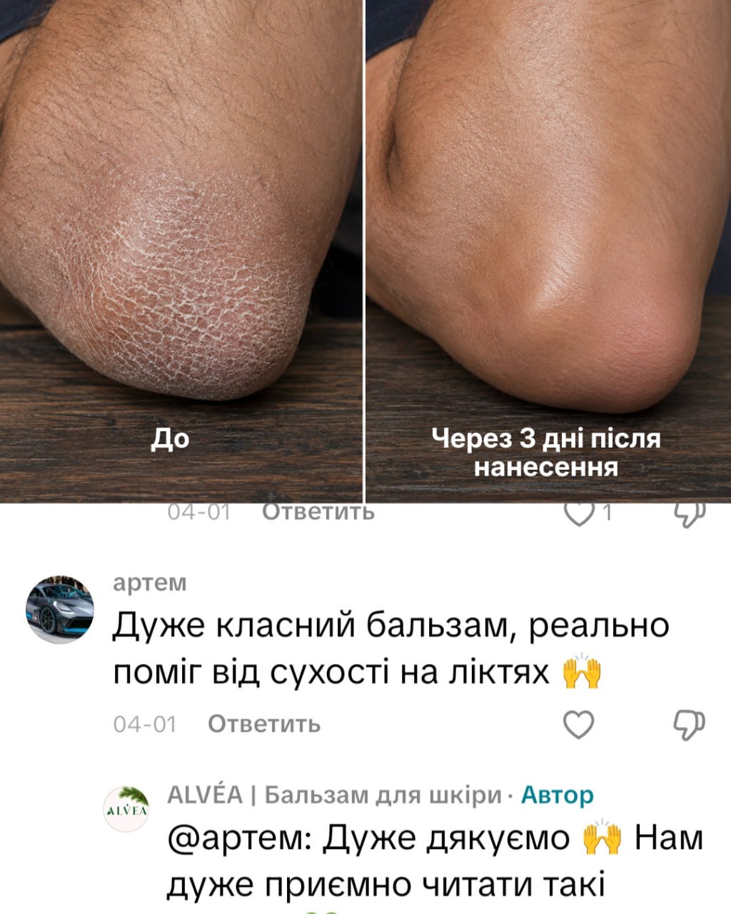 Відгук покупця ALVEA — догляд за ліктями