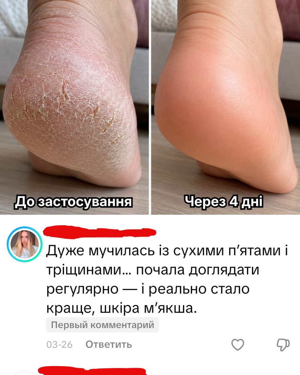 Відгук покупця ALVEA — догляд за п'ятами